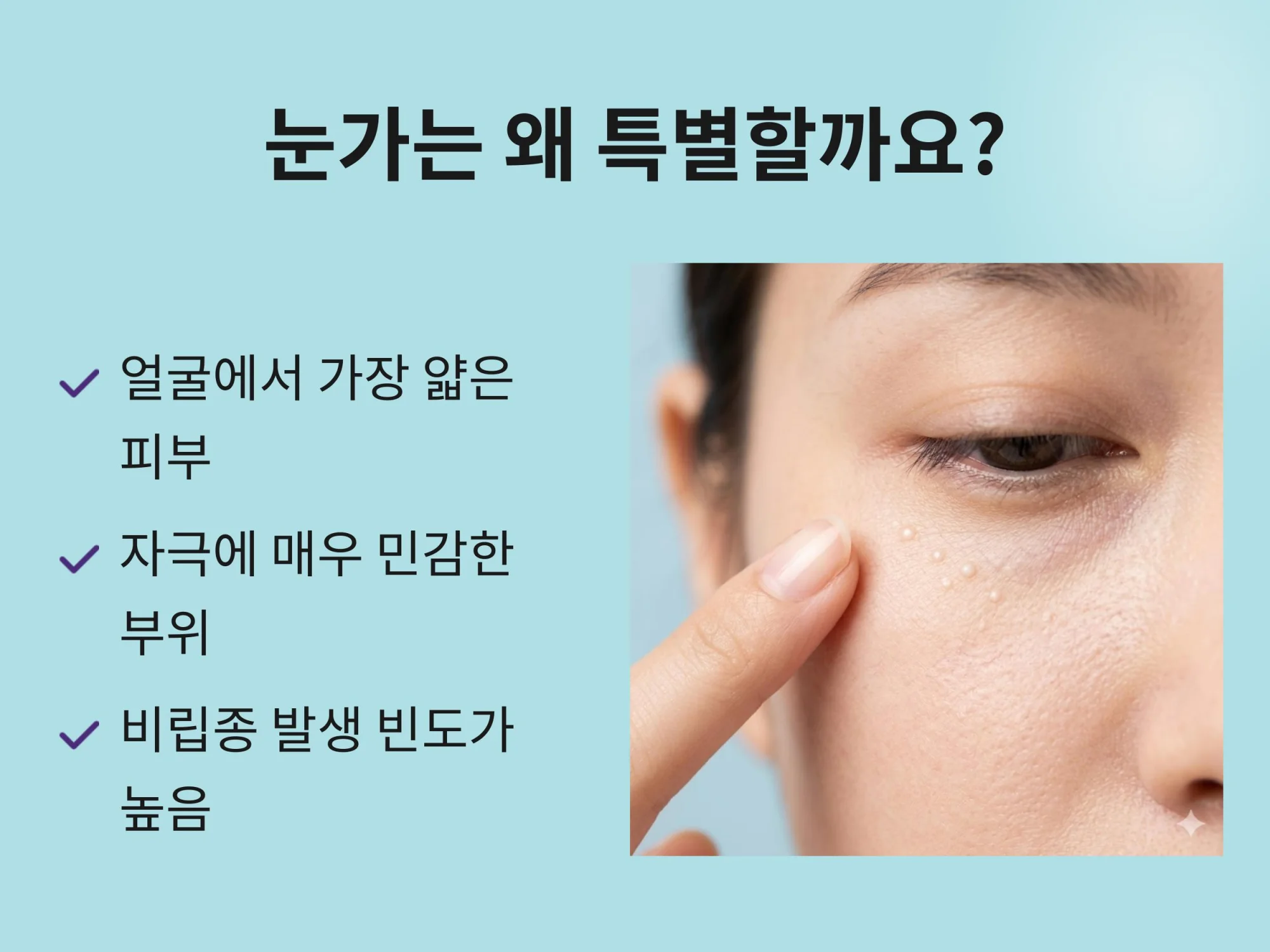 "눈가 피부의 특징 설명: 얼굴에서 가장 얇은 피부, 자극에 민감한 부위, 비립종 발생 빈도가 높음을 나타내는 인포그래픽과 여성의 눈가 클로즈업 사진"