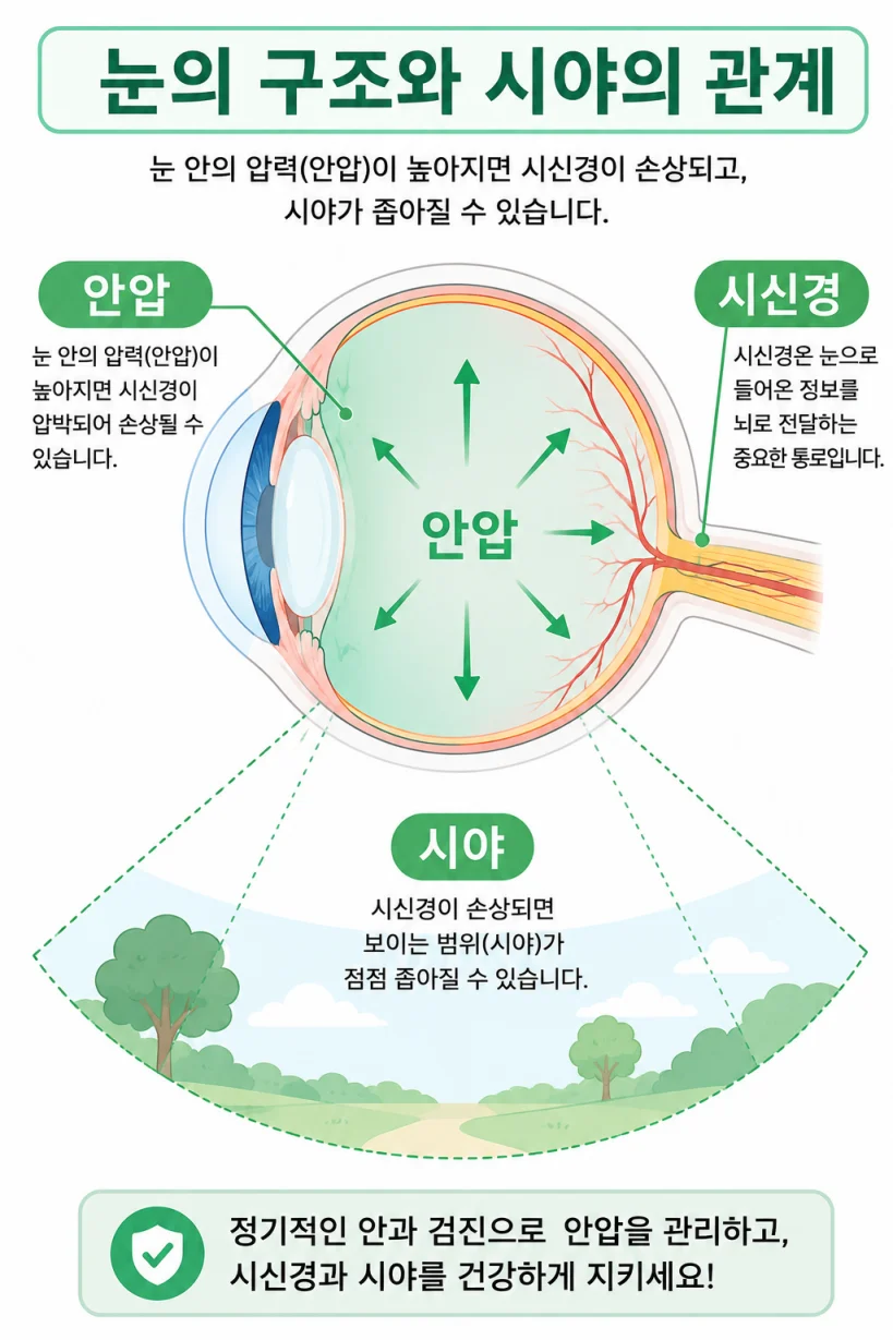 녹내장 초기 증상 눈 건강 정보 일러스트