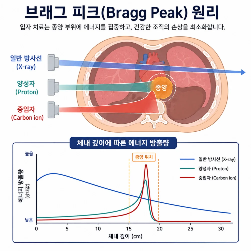브래그 피크 원리 다이어그램 입자 방사선 에너지 분포