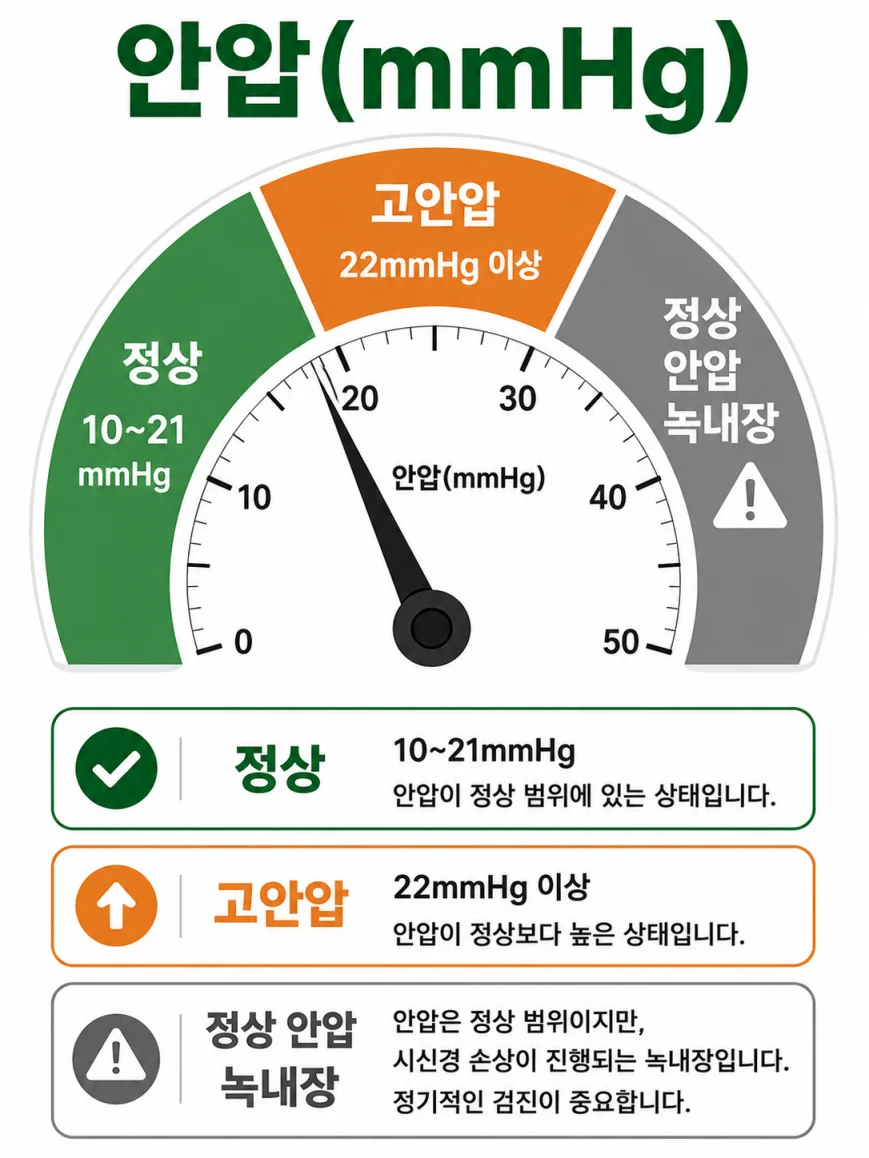 안압 정상 수치 10~21mmHg 고안압 기준 의학 일러스트
