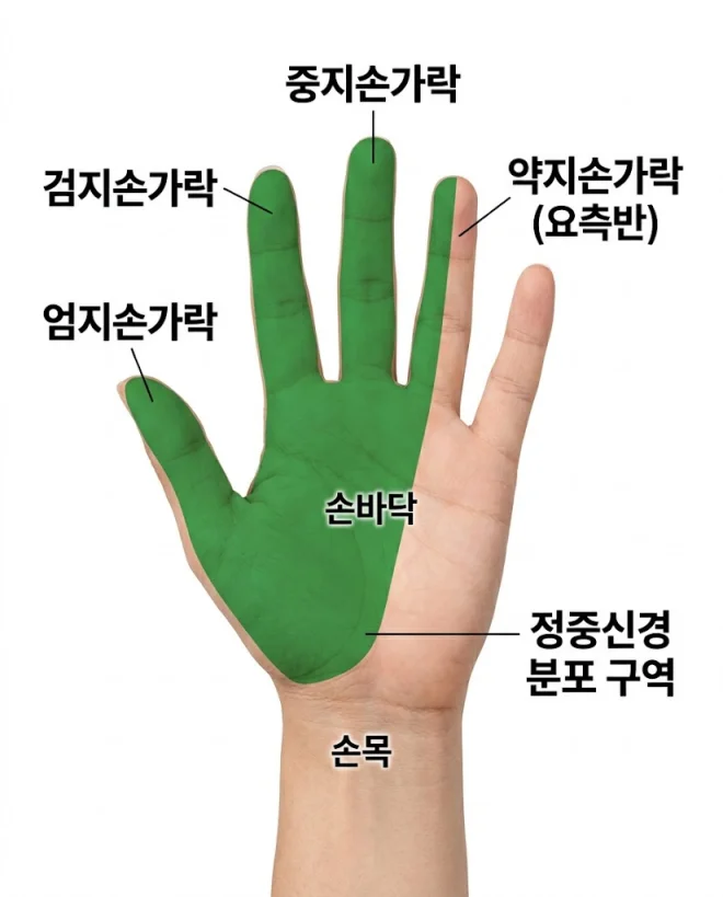 손목터널증후군 정중신경 담당 손가락 위치 일러스트
