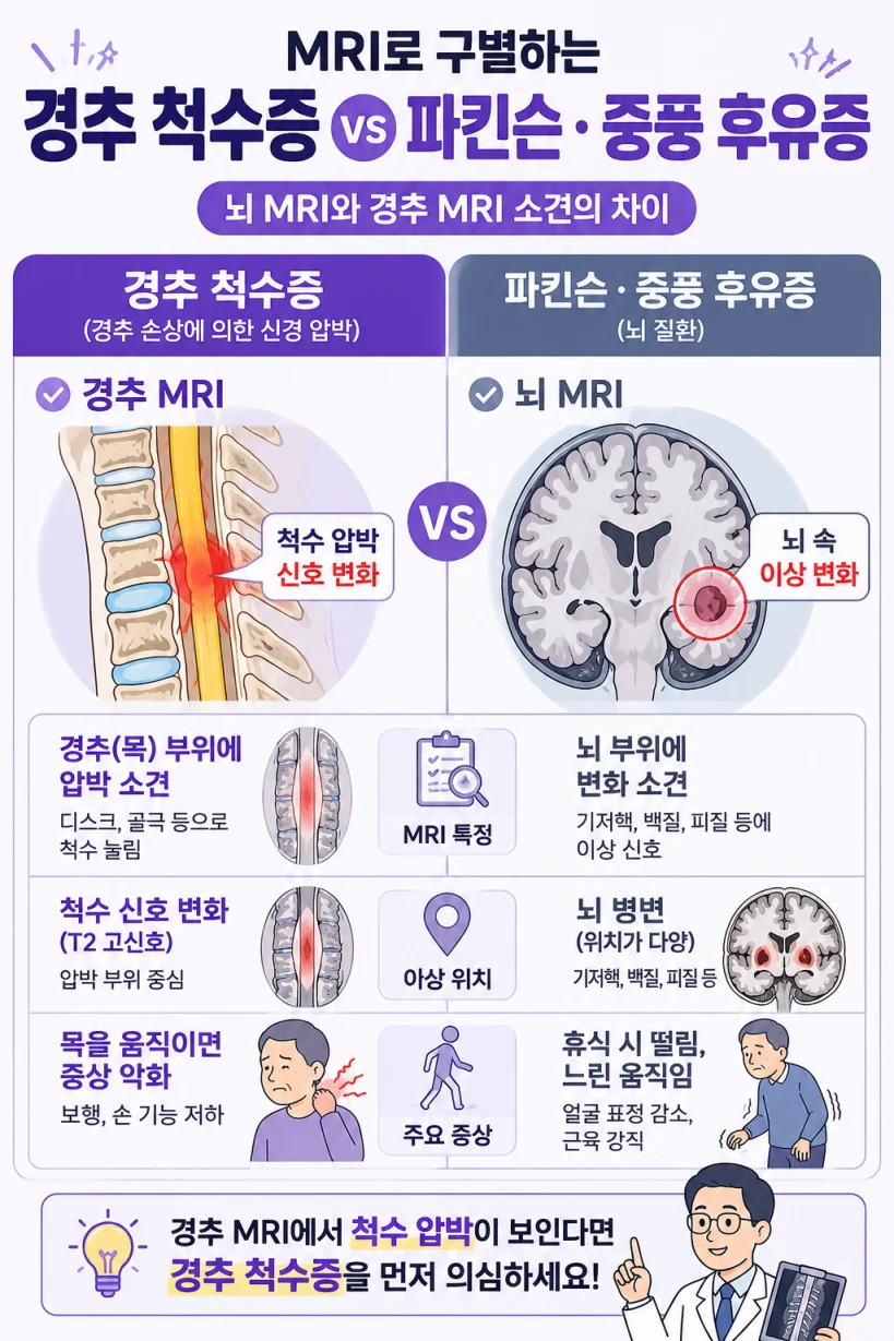 경추척수증과 파킨슨병 감별 MRI 일러스트
