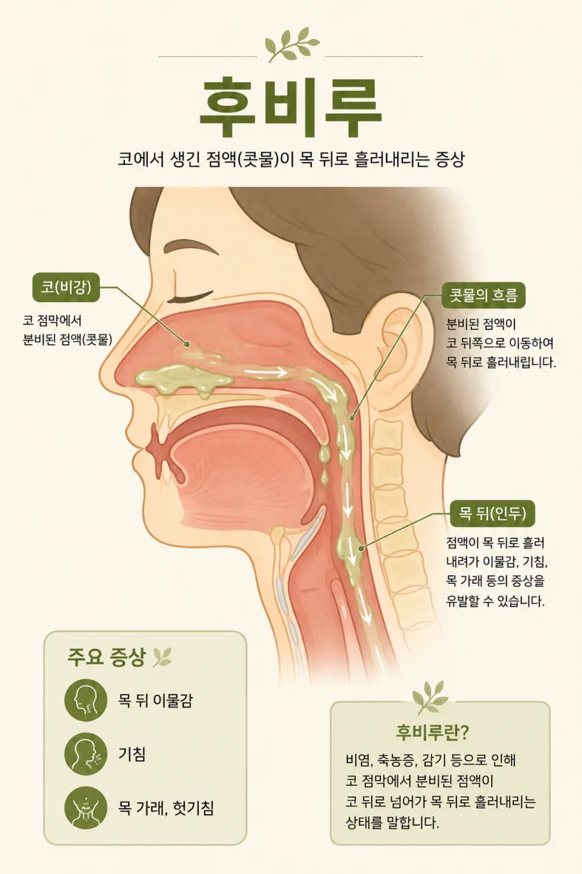 후비루로 콧물이 목 뒤로 넘어가는 경로를 표현한 일러스트